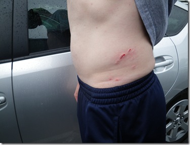 dogbite